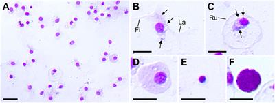 Establishment of the immunological self in juvenile Patiria pectinifera post-metamorphosis